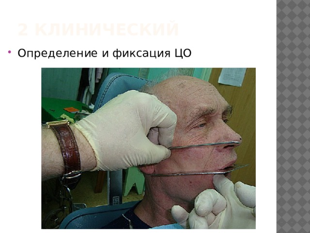 2 клинический Определение и фиксация ЦО 