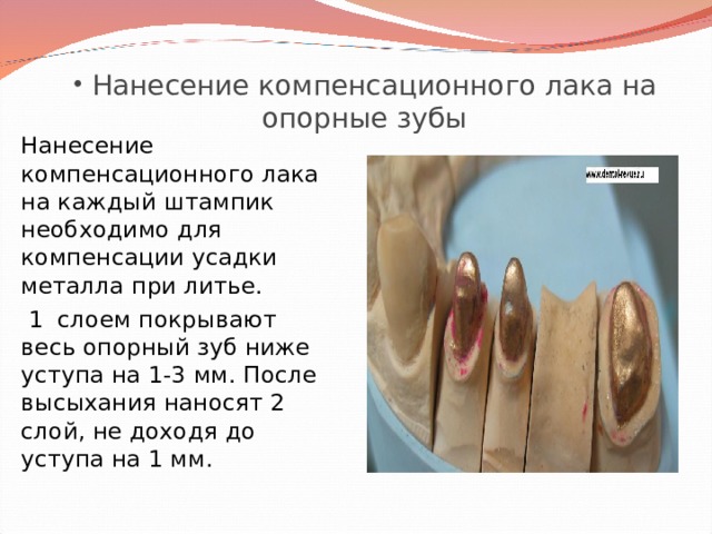  Нанесение компенсационного лака на опорные зубы Нанесение компенсационного лака на каждый штампик необходимо для компенсации усадки металла при литье.  1 слоем покрывают весь опорный зуб ниже уступа на 1-3 мм. После высыхания наносят 2 слой, не доходя до уступа на 1 мм. 