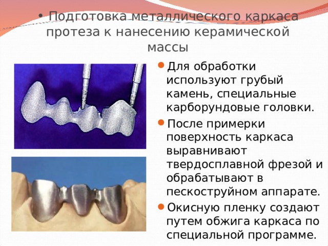  Подготовка металлического каркаса протеза к нанесению керамической массы Для обработки используют грубый камень, специальные карборундовые головки. После примерки поверхность каркаса выравнивают твердосплавной фрезой и обрабатывают в пескоструйном аппарате. Окисную пленку создают путем обжига каркаса по специальной программе. 