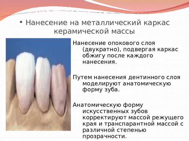  Нанесение на металлический каркас керамической массы Нанесение опокового слоя (двукратно), подвергая каркас обжигу после каждого нанесения. Путем нанесения дентинного слоя моделируют анатомическую форму зуба. Анатомическую форму искусственных зубов корректируют массой режущего края и транспарантной массой с различной степенью прозрачности. 