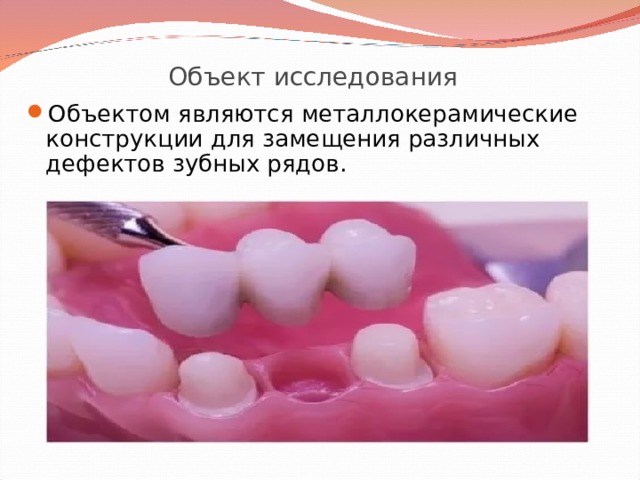Объект исследования Объектом являются металлокерамические конструкции для замещения различных дефектов зубных рядов. 