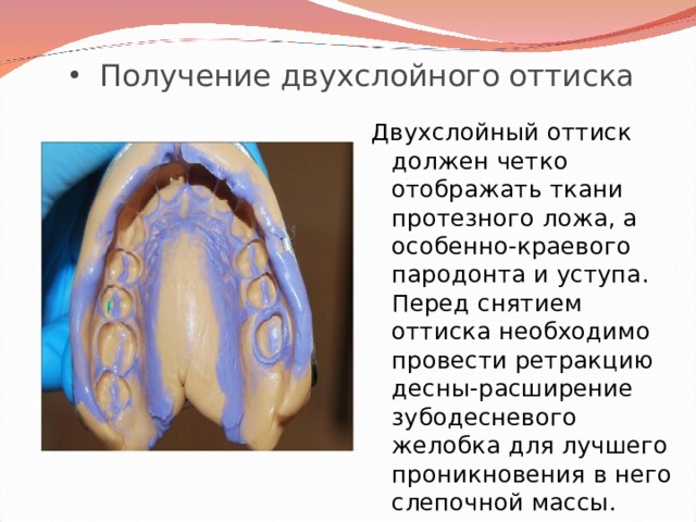 Протезное поле и протезное ложе. Двухслойный оттиск. Двухслойный одноэтапный оттиск. Методика получения оттисков. Двухслойные оттиски материалы.