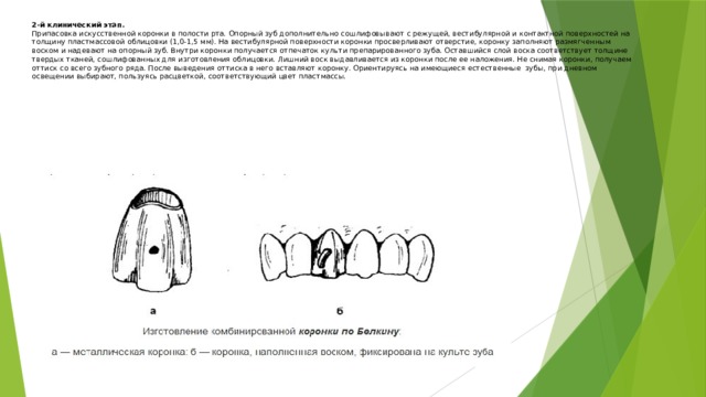 Варианты комбинированных коронок и их назначение