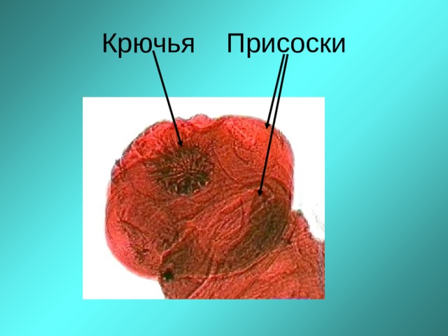 Крючья Присоски  