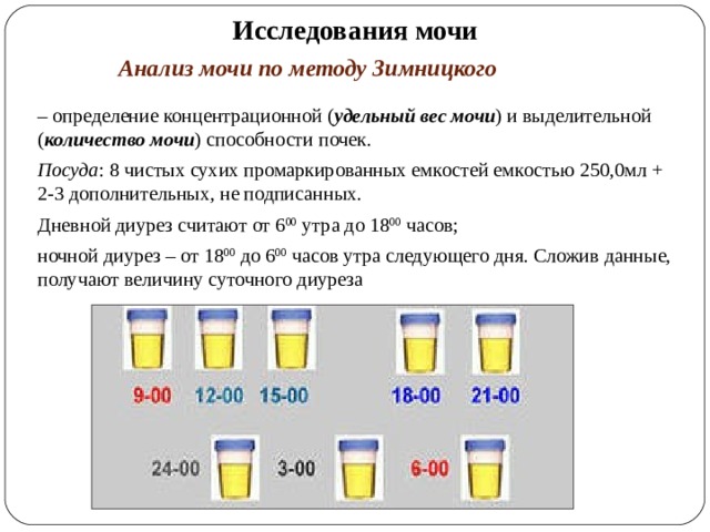 Сколько нужно собрать. Анализ мочи проба по Зимницкому. Метод исследования мочи по Зимницкому. Проба мочи по Зимницкому методика исследования. Анализ мочи по Нечипоренко и Зимницкому.