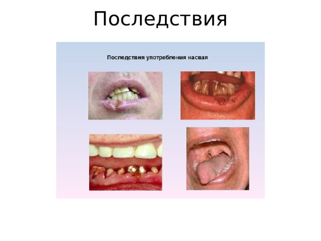 Последствия 