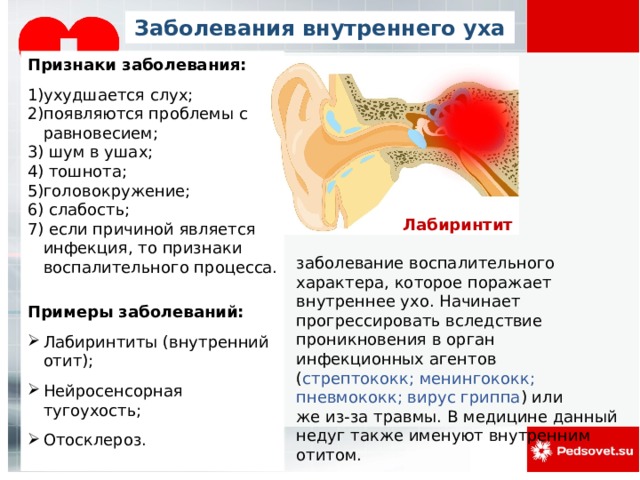 Заболевания внутреннего уха Признаки заболевания: ухудшается слух; появляются проблемы с равновесием; 3) шум в ушах; 4) тошнота; головокружение; 6) слабость; 7) если причиной является инфекция, то признаки воспалительного процесса. Примеры заболеваний: Лабиринтиты (внутренний отит); Нейросенсорная тугоухость; Отосклероз.   Лабиринтит  заболевание воспалительного характера, которое поражает внутреннее ухо. Начинает прогрессировать вследствие проникновения в орган инфекционных агентов ( стрептококк; менингококк; пневмококк; вирус гриппа ) или  же из-за травмы. В медицине данный недуг также именуют внутренним отитом.    