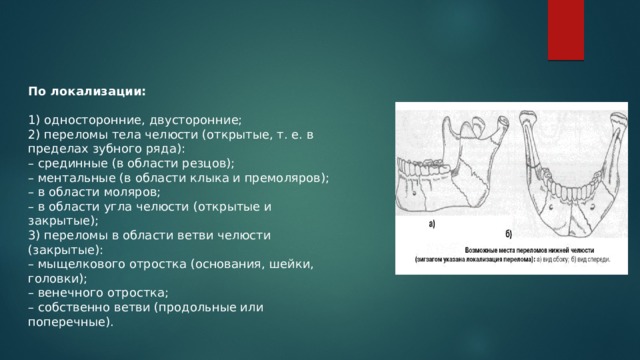 Закрытый перелом нижней челюсти карта вызова локальный статус