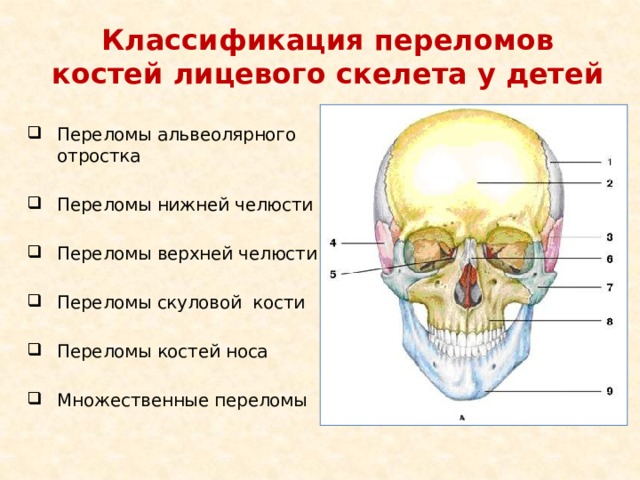 Классификация переломов костей лицевого скелета у детей Переломы альвеолярного отростка Переломы нижней челюсти Переломы верхней челюсти Переломы скуловой кости Переломы костей носа Множественные переломы 
