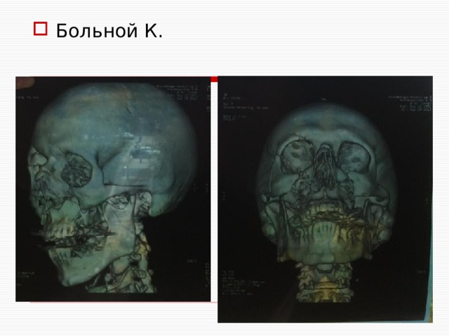 Больной К. 