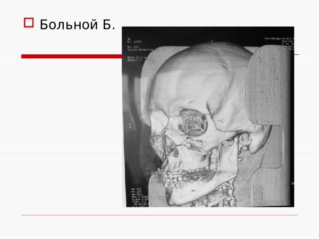 Больной Б. 