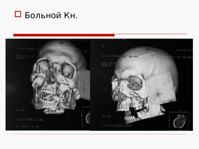 Больной Кн. 