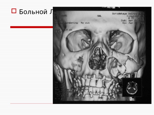 Больной Л. 
