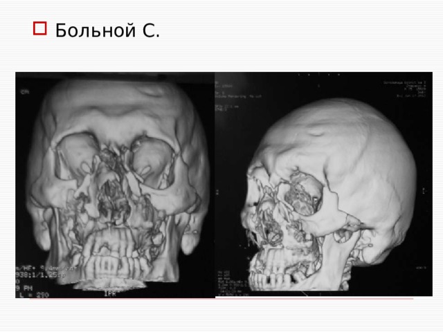Больной С. 
