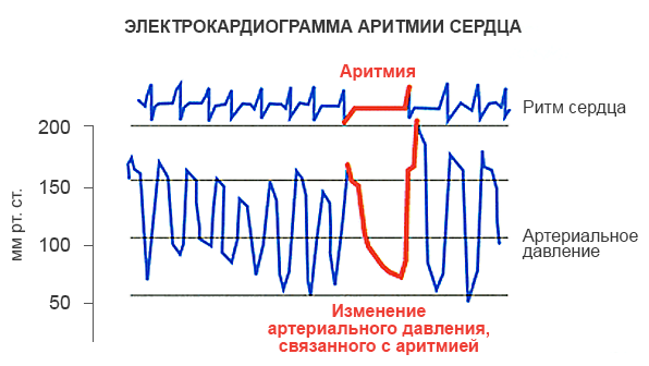 Исследовательский проект сердечно сосудистые заболевания