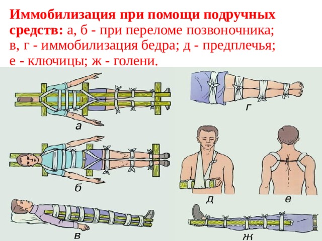 При переломах конечностей