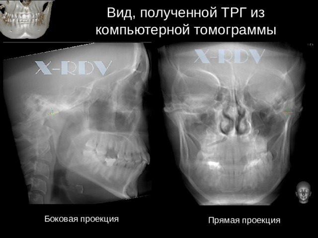 Лучевая диагностика внчс презентация