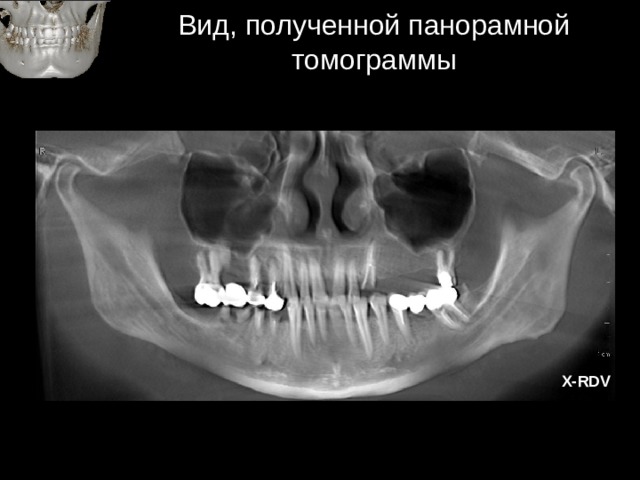 Дополнительные методы обследования внчс презентация