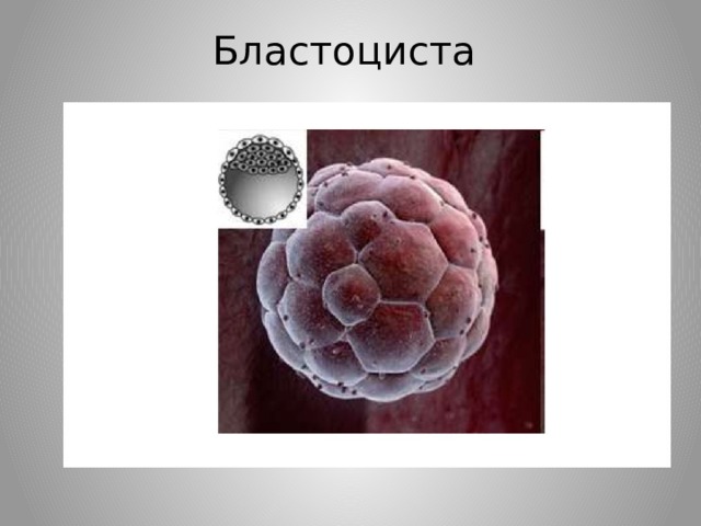 Бластоциста 