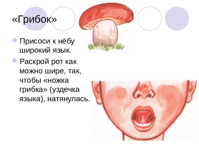 «Грибок» Присоси к нёбу широкий язык. Раскрой рот как можно шире, так, чтобы «ножка грибка» (уздечка языка), натянулась. 