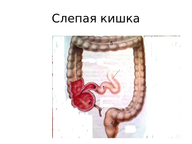 Купол слепой кишки схема