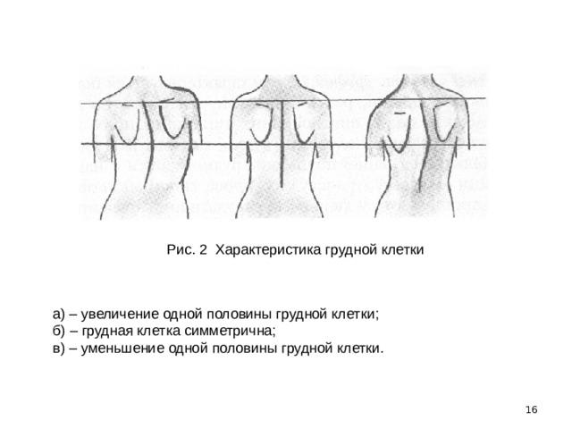 Как должна выглядеть грудная клетка