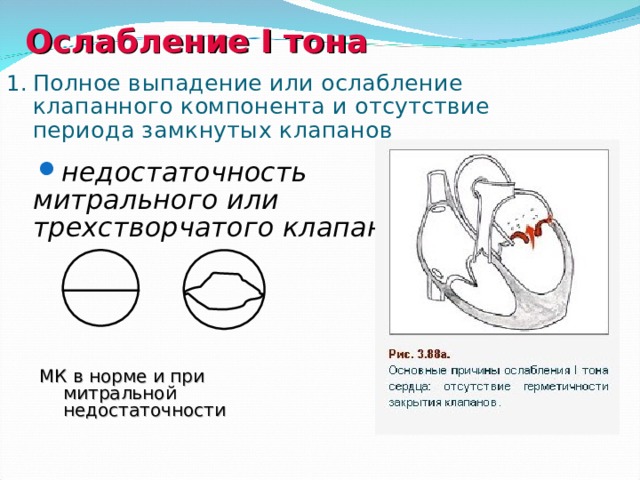 При фкт стенка каверны имеет