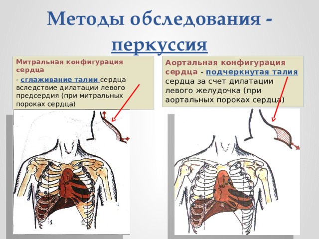 Нормальная конфигурация сердца рисунок