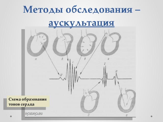 Тоны сердца схема