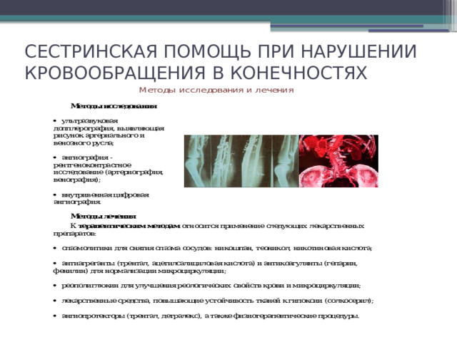 Долгосрочная цель в плане сестринского ухода за пациентом с облитерирующим эндартериитом