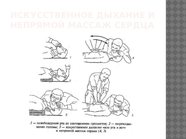 Презентация искусственное дыхание и непрямой массаж сердца