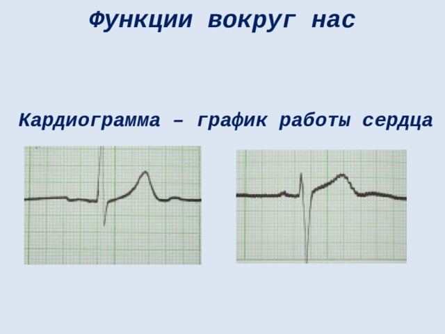 Функции вокруг нас Кардиограмма – график работы сердца 
