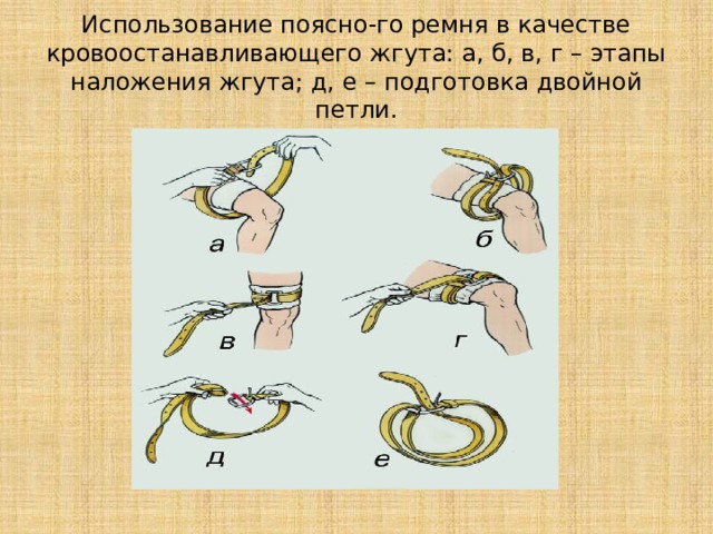 Презентация на тему жгуты