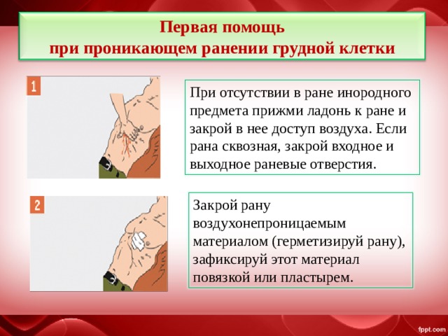 Первая помощь  при проникающем ранении грудной клетки При отсутствии в ране инородного предмета прижми ладонь к ране и закрой в нее доступ воздуха. Если рана сквозная, закрой входное и выходное раневые отверстия. Закрой рану воздухонепроницаемым материалом (герметизируй рану), зафиксируй этот материал повязкой или пластырем. 