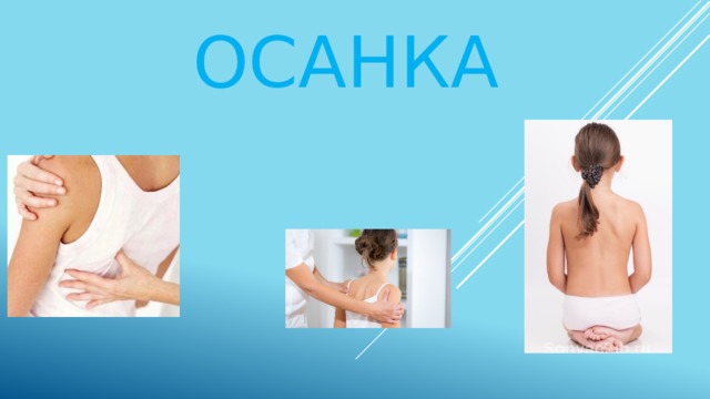 осанка 