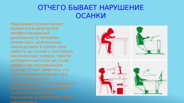 Отчего бывает. Нарушение осанки в профессиональной деятельности. Долгое нахождение в одной позе. Длительное нахождение в вынужденной позе. Гигиена правильной осанки внеурочка 3 класс.