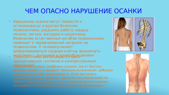 Чем опасно нарушение осанки Нарушение осанки могут привести к остеохондрозу и другим болезням позвоночника, ухудшить работу сердца, печени, легких, желудка и кишечника. Изменение естественных изгибов позвоночника приводит к неравномерной нагрузке на позвоночник. У человека может деформироваться грудная клетка, возникнуть проблемы с дыханием и кровообращением. Плоская спина увеличивается риск возникновения сколиоза и компрессионных переломов. Нарушение осанки, особенно сколиоз, могут быстро прогрессировать и вызвать тяжелые осложнения: рёберно-позвоночный горб, инвалидность. Если не начать коррекцию осанки вовремя, физические упражнения не помогут вернуть позвоночник в нормальное положение, понадобиться операция для фиксации позвоночника. 