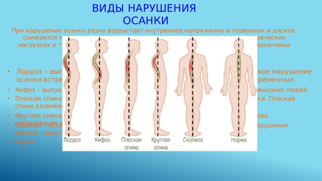 Виды нарушения  осанки При нарушение осанки резко возрастает внутреннее напряжение в позвонках и дисках, снижается гибкость позвоночника, он становиться более уязвим при физических нагрузках и травмах, искривляется и приводит к таким деформациям позвоночника как сколиоз, кифоз и лордоз. Различают следующие виды нарушения осанки: Лордоз – выпуклость вперед поясничного отдела позвоночника. Такое нарушение осанки встречается у гимнастов, профессиональных танцоров и беременных. Кифоз – выпуклость назад грудного отдела. Кифоз обычно бывает у очень высоких людей. Плоская спина – характеризуется сглаженностью всех изгибов позвоночника. Плоская спина развивается у боксеров. Круглая спина или сутулость – опущенные плечи, наклоненная вперед голова, нагруженная шея. Сколиоз – искривление позвоночника вбок. Характерный признак такого нарушения осенки – одно плечо выше другого. норма 