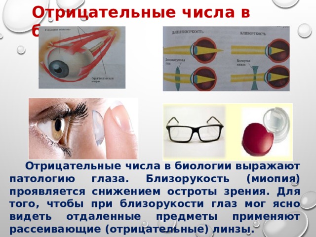 Дополните утверждения изображение в близоруком глазу