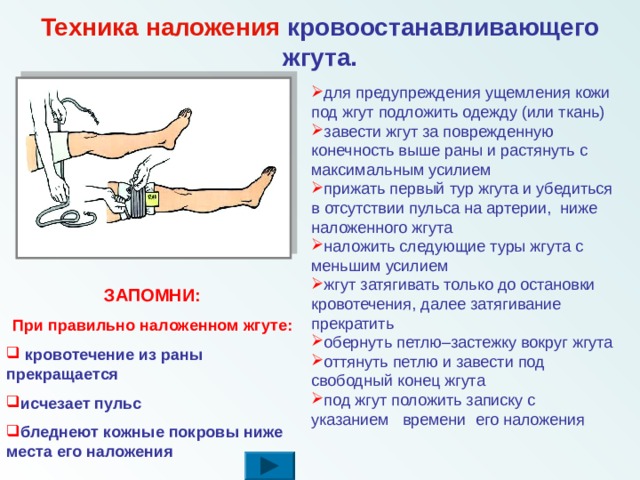 Правила наложения кровоостанавливающего жгута презентация