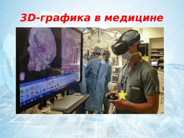 3D-графика в медицине 