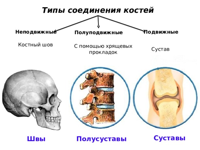 Подвижное соединение между. Неподвижные полуподвижные и подвижные соединения костей. Типы соединения костей полуподвижные. Неподвижные соединения костей биология 8 класс. Соединения костей неподвижные полуподвижные подвижные суставы.