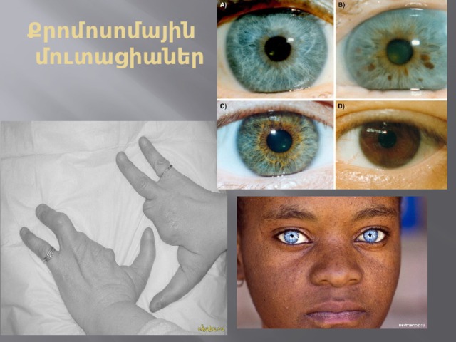 Քրոմոսոմային  մուտացիաներ 