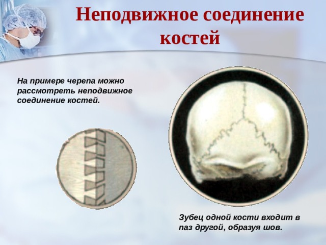 Как называется неподвижное соединение костей фото Shkola-2.ru