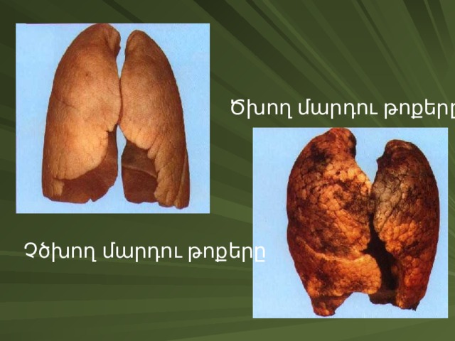 Ծխող մարդու թոքերը Չծխող մարդու թոքերը 