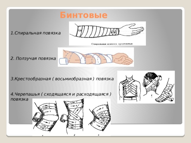 Типы бинтовых повязок рисунок