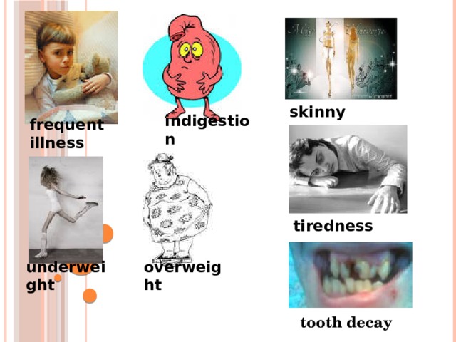 skinny indigestion frequent illness tiredness underweight overweight tooth decay 