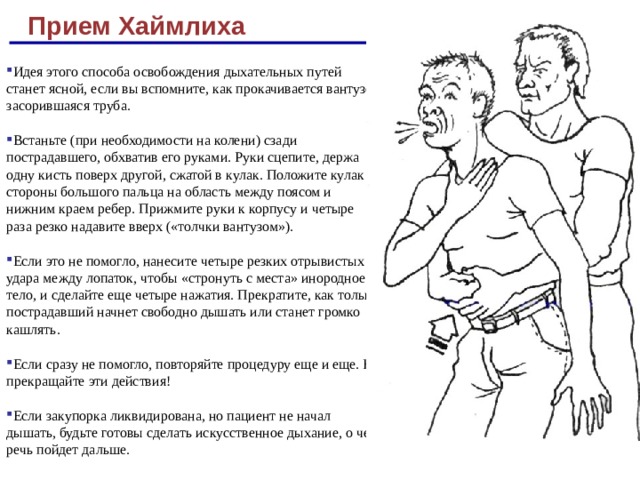 Как оказать первую помощь, если человек подавился - Инфографика ТАСС