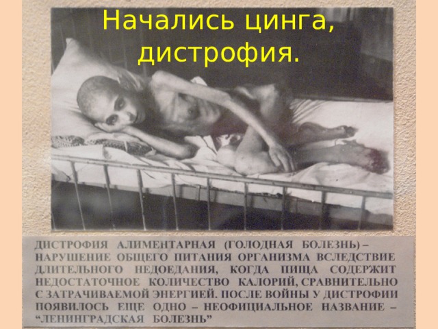 Начались цинга, дистрофия.
