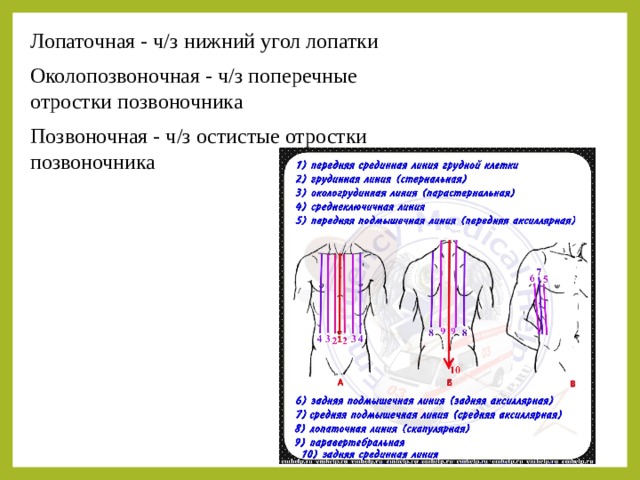 Лопаточная - ч/з нижний угол лопатки Околопозвоночная - ч/з поперечные отростки позвоночника Позвоночная - ч/з остистые отростки позвоночника 